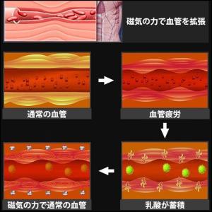 ダイエット 指輪 ストライプ リング 器具 磁...の詳細画像3