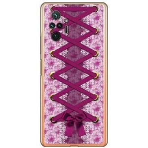 Redmi Note 10 Pro ケース コルセット ピンク スマホケース (受注生産)