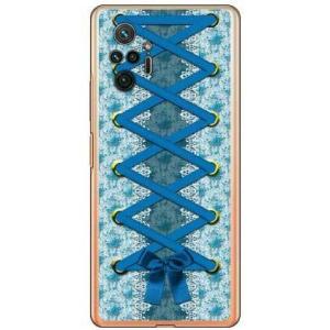 Redmi Note 10 Pro ケース コルセット ブルー スマホケース (受注生産)