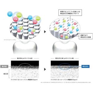 3M クリンプロ 歯みがきペースト F1450...の詳細画像4