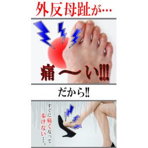 外反母趾対策 テーピング ガイハン出っ張りサポ...の詳細画像1