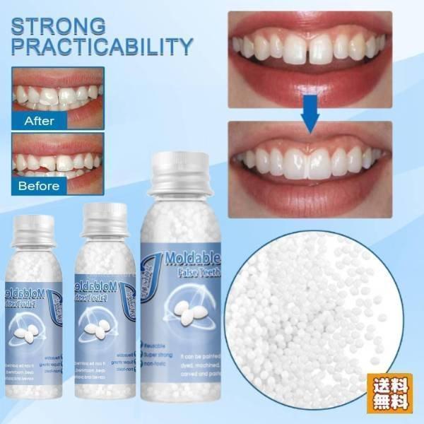 歯の修復ツール 一時的 入れ歯 成形可能 固形接着剤 仮歯 義歯 隙間入れ 樹脂ビーズ
