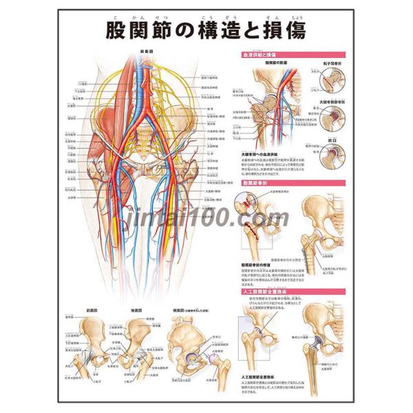 「股関節の構造と損傷」医学ポスター ポスターB3サイズ  人体解剖学図ポスター 医学チャート