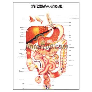 「消化器系の諸疾患」医学ポスター ポスターB2サイズ  人体解剖学図ポスター 医学チャート 　