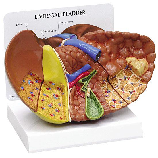 人体模型　肝臓と諸疾患　日本語訳付き　GPI Anatomicals