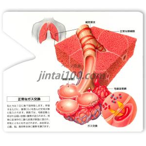 「喘息と慢性閉塞性肺疾患(COPD)」型抜き絵...の詳細画像1