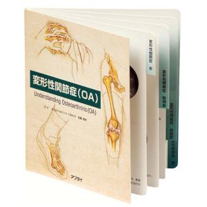 「変形性関節症（OA) 」型抜き絵本 疾患説明用絵本 医学絵本