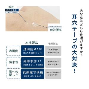 耳つぼシール 粒タイプ 300粒 表情筋 ほう...の詳細画像5