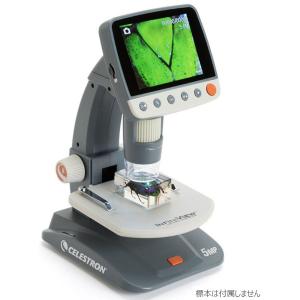 ビクセン InfiniView LCD デジタル顕微鏡 VIXEN CELESTRON INFINIVIEWLCDケンビキョウ 返品種別A｜joshin