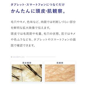 3R-MSUSB280 USB接続マイクロスコ...の詳細画像2