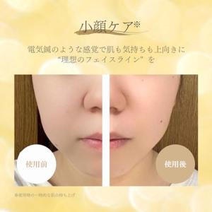 【20%OFFクーポン】EMS美顔器 ems ...の詳細画像5