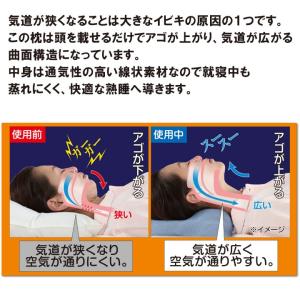 いびき枕 いびき対策グッズ 父の日 快眠枕 安...の詳細画像1