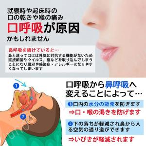 マウステープ 口閉じテープ 口閉じるテープ30...の詳細画像2