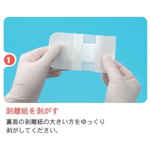 ミリオンエイド 粘着パット No.100 創傷...の詳細画像4
