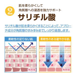 クリアフットヴェール 足裏 ガサガサ ジュクジ...の詳細画像5