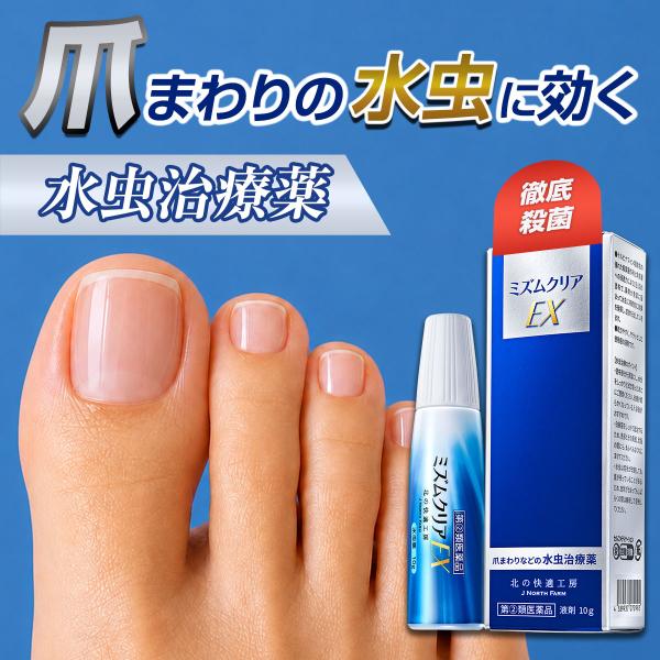 【指定第2類医薬品】爪まわりの水虫治療薬『ミズムクリアEX』10g 水虫治療 水虫治療薬 水虫薬 白...
