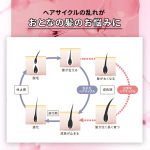 育毛剤 レディース 加美乃素 頭皮 保湿 女性...の詳細画像5