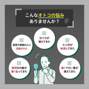 ミノキシジル 5% 発毛剤 ミノキ ジェネリッ...の詳細画像3