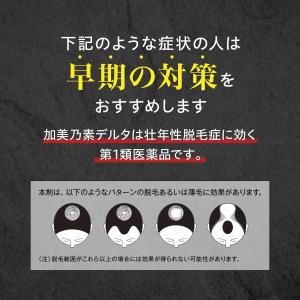 ミノキシジル 5% 発毛剤 ミノキ ジェネリッ...の詳細画像4