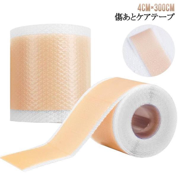 帝王切開 傷 ケア テープ 帝王切開 傷 テープ 帝王切開 傷跡 テープ 4cm×300cm 傷跡テ...