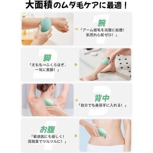 無痛脱毛器 【2025アップグレード】 角質除...の詳細画像2