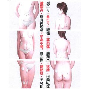 アドバンス低周波治療器ウィンザード*純正部品*...の詳細画像5