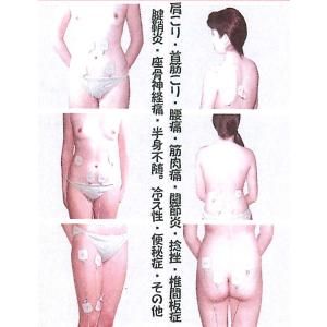 アドバンス低周波治療器ウィンザード*純正部品*...の詳細画像4