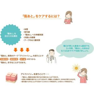 アトファイン Mサイズ (6枚入り) ニチバン...の詳細画像3