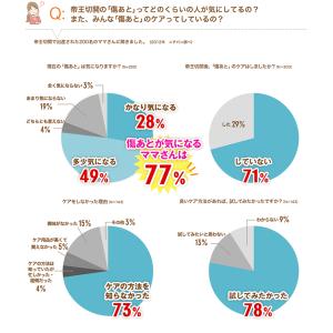 帝王切開 術後セット アトファイン 傷あとケア...の詳細画像3