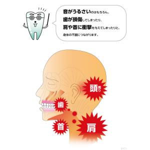 歯ぎしりピタリ 歯ぎしり 対策マウスピースの詳細画像1