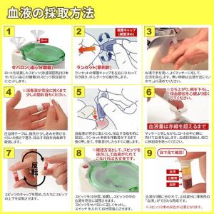 アレルギー検査 36項目(食物アレルゲン・花粉...の詳細画像3