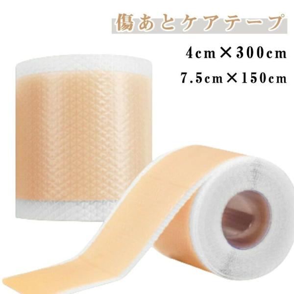 傷あとケアテープ 帝王切開 傷跡ケアテープ ケロイド テープ 貼り心地にもこだわった 傷あとケア用シ...