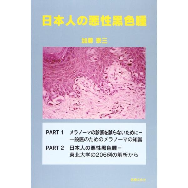 日本人の悪性黒色腫