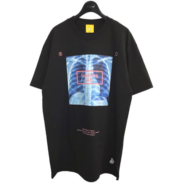 エフアールツー FR2 smoking killsレントゲンプリントTシャツ ブラック サイズ：L
