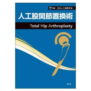 人工股関節置換術