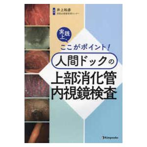 実践上、ここがポイント！人間ドックの上部消化管内視鏡検査