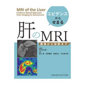 エビデンスからせまる肝のＭＲＩ―撮像から診断まで