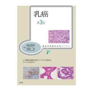 腫瘍病理鑑別診断アトラス 乳癌 (第3版) : 9784830622625