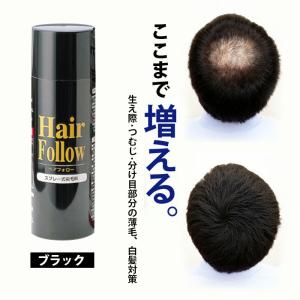 スカルプD アンファー ブラックカバースプレー グリーンフローラルの