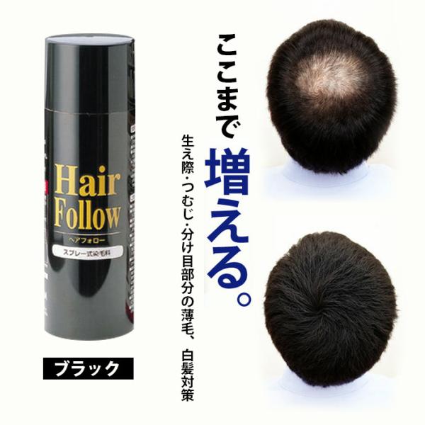 正規品 ヘアフォロースプレー ブラック 黒 薄毛隠し 白髪隠し 増毛 ハゲかくし スプレー 髪のボリ...