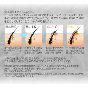 美顔器 ニキビケア専用 母の日 ギフト ニキビ...の詳細画像2