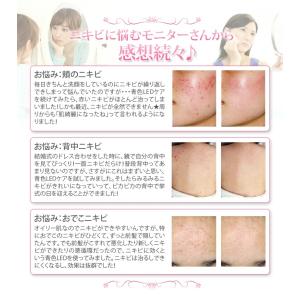 美顔器 ニキビケア専用 母の日 ギフト ニキビ...の詳細画像5