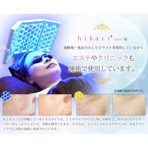 美顔器 シミ取り トータルケア 光美容器 赤色...の詳細画像2