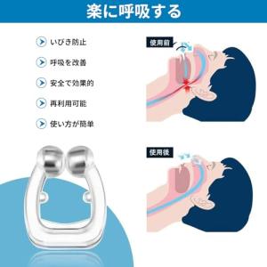 Nobetta いびき防止グッズ いびき対策睡...の詳細画像1