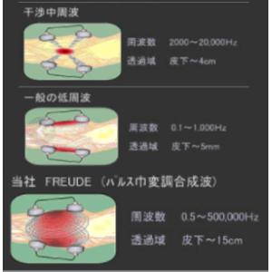 送料無料 (株)テクノリード フロイデ 本体 ...の詳細画像1
