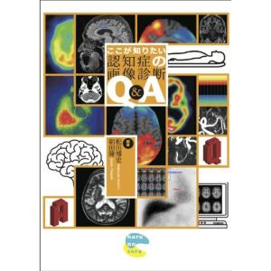 ここが知りたい認知症の画像診断Q&A｜神戸リセールショップ4号店