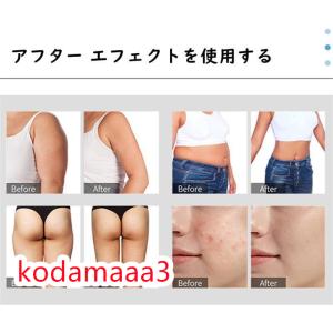 家庭用/業務用 3in1 40Khzキャビテー...の詳細画像5