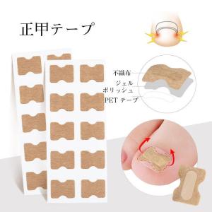 巻き爪矯正 セット 自分で 20分だけ 爪切り...の詳細画像2