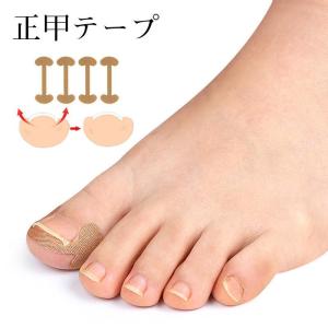 巻き爪矯正 セット 自分で 20分だけ 爪切り...の詳細画像3