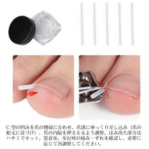 巻き爪矯正 セット 自分で 20分だけ 爪切り...の詳細画像4